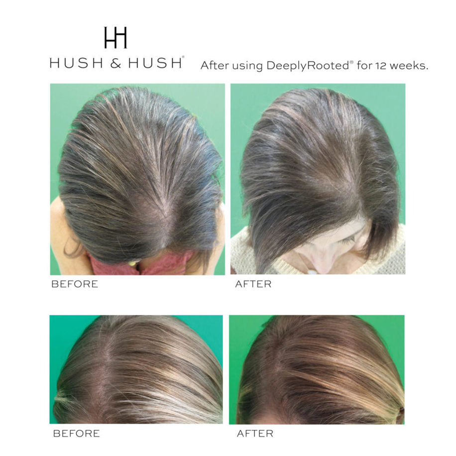 Supliment Hiper Concentrat pentru Sănătatea Părului Hush & Hush DeeplyRooted 120 Capsule