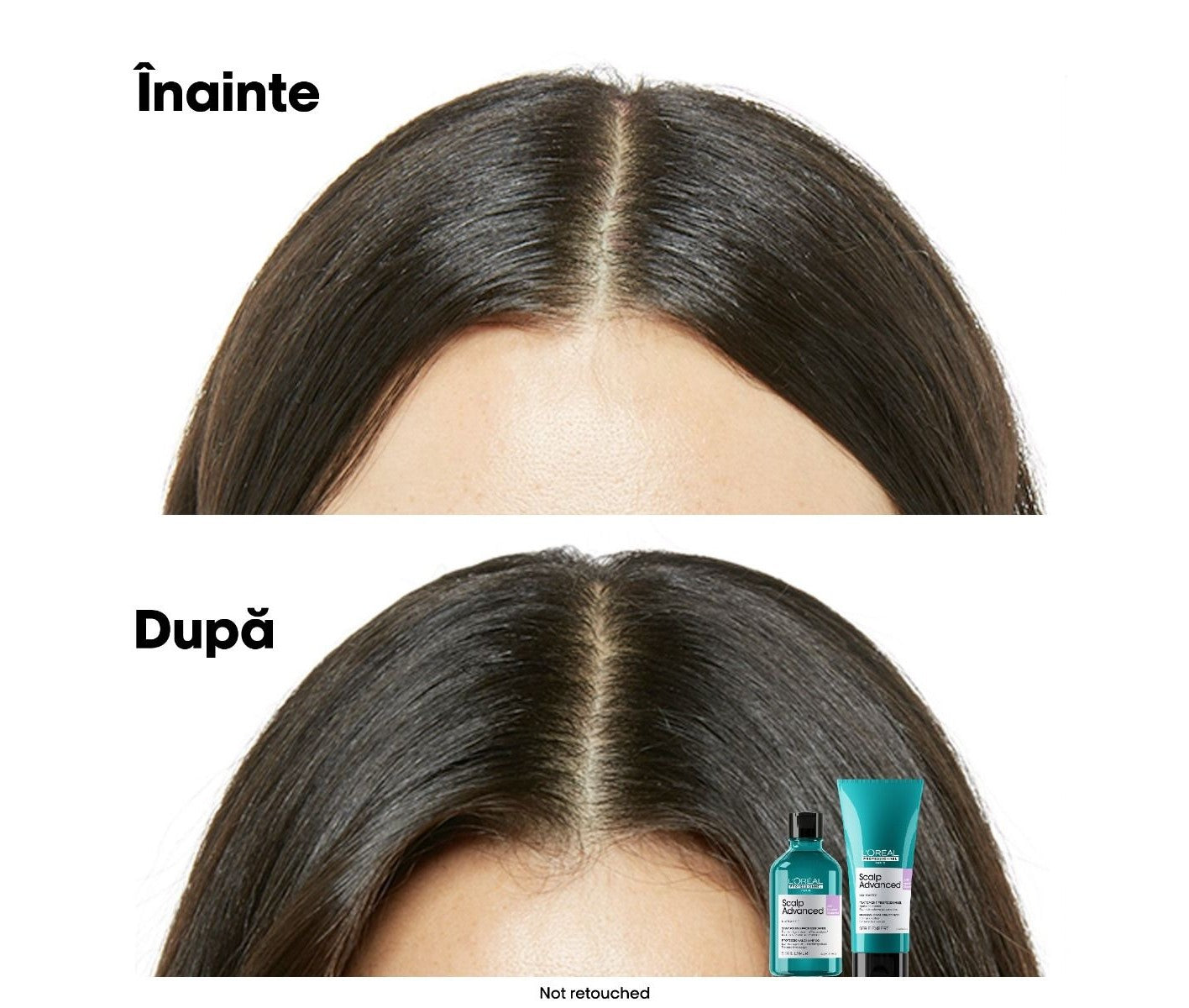 Sampon pentru scalp sensibil L’Oreal Professionnel Serie Expert Scalp Advanced, cu niacinamide 300ml
