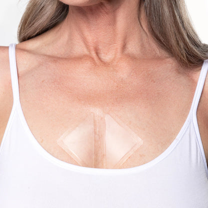 Karuna Age Rewind XL Microneedle Patches – plasturi XL cu microace, retinol și peptide