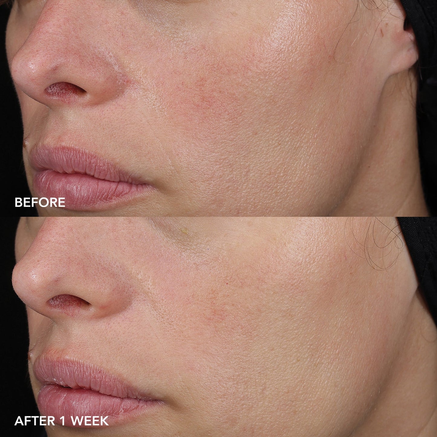 IMAGE MD Barrier Repair Recovery Balm - Barrier Repair Balm for Sensitive Skin