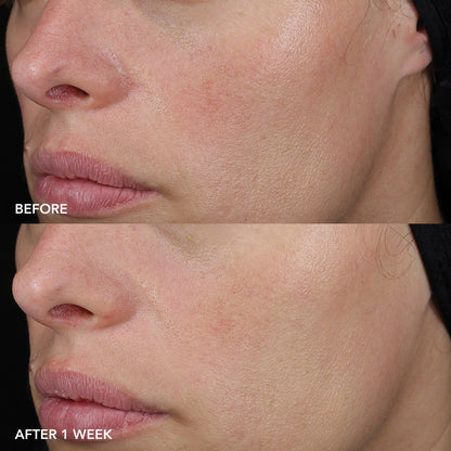 IMAGE MD Barrier Repair Recovery Balm - Barrier Repair Balm for Sensitive Skin