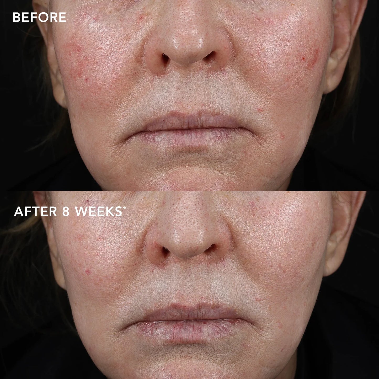 IMAGE MD Biotech Longevity Crème – Advanced Anti-Aging Cream with NAD+ Booster