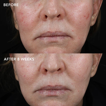 IMAGE MD Biotech Longevity Crème – Advanced Anti-Aging Cream with NAD+ Booster