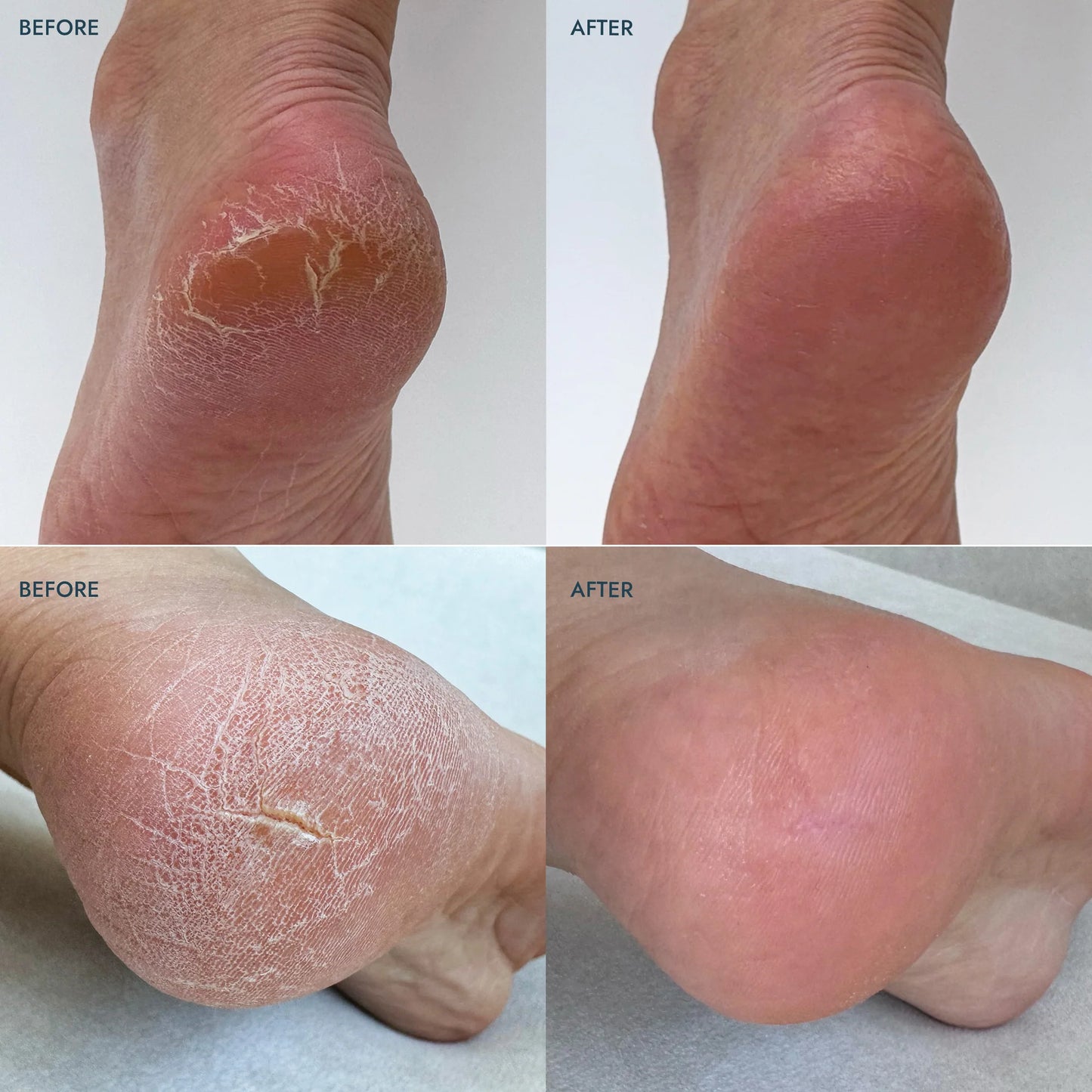 Balsam stick pentru calcaie uscate Voesh Heel Repair Balm